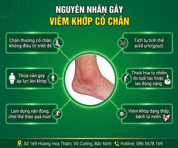 Viêm khớp cổ chân: Cách nhận biết sớm và điều trị hiệu quả hiện nay