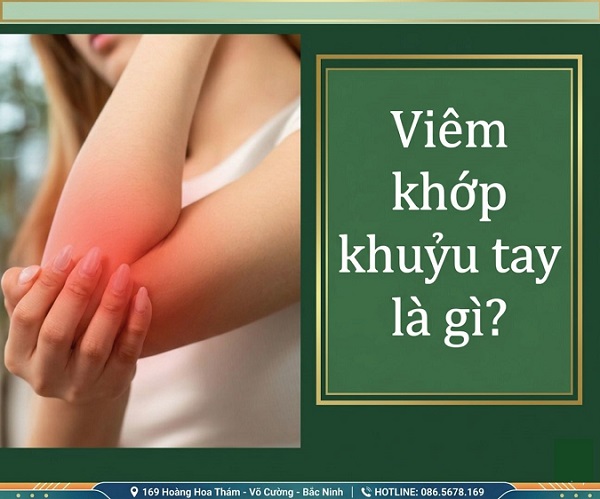 Tưởng đau nhẹ, ai ngờ viêm khớp khuỷu tay tiến triển nhanh đến vậy!