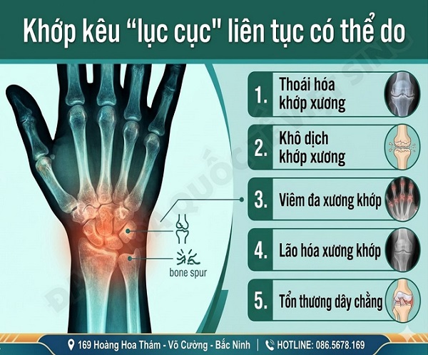 Khớp kêu “lục cục” liên tục – Cảnh báo xương khớp đang gặp vấn đề?