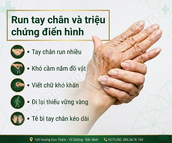 Run tay chân liên tục – Nguyên nhân đằng sau là gì?
