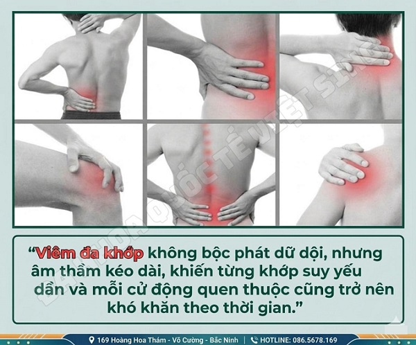 Đau khớp chỗ này lan sang chỗ khác – Dấu hiệu bạn không nên coi thường!