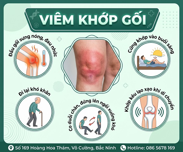 Đầu gối nóng, sưng đỏ là bệnh gì? Cảnh báo 5 nguyên nhân không nên chủ quan